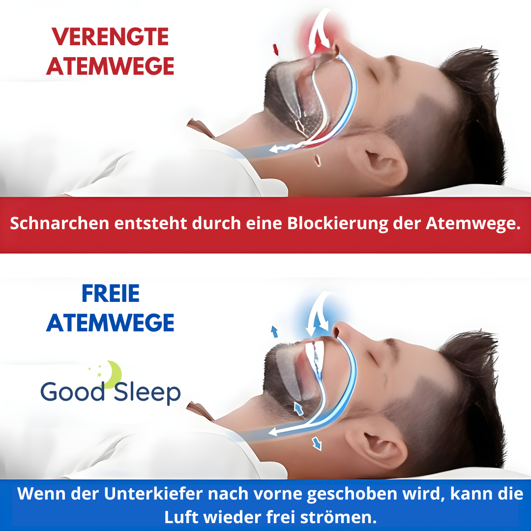 Good Sleep Anti-Schnarch-Mundstück